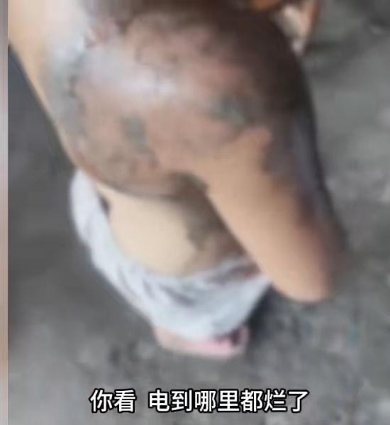 万万没有想到，一个打火机的电击后威力这么大？2025年9月15日，广西钦州发