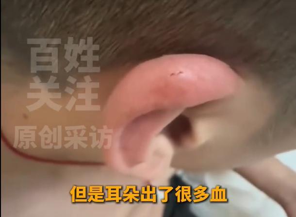 上海，一名游客入住一家连锁酒店，半夜睡着之后，感觉有东西咬了自己的耳朵，打开灯照