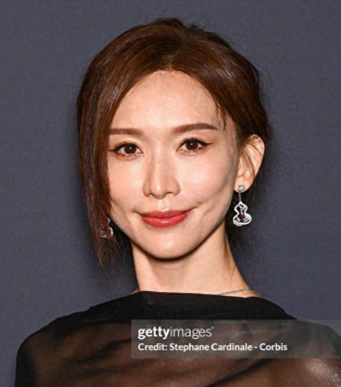 51岁林志玲现身戛纳，瘦到脱相腋下松垮，面露凶相。网友：婚后判若两人！