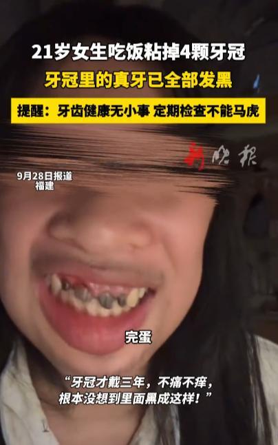 “离了个大谱！”9月28日，福建，一21岁女生吃饭时不小心把自己的四颗牙冠粘掉了