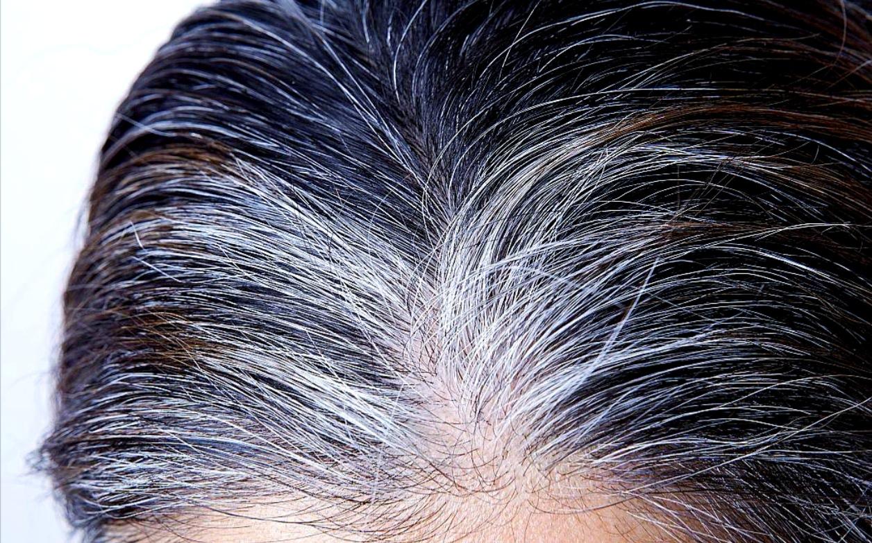 白头发越长越多？别只愁染发，可能是身体在提醒你缺了这几种营养！每次照镜子，发