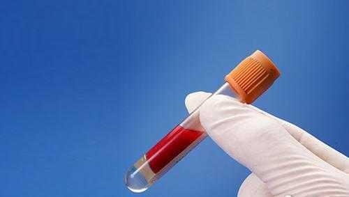 身体发出这几种信号, 暗示你血脂高了, 常吃这些食物, 降血脂、通血管