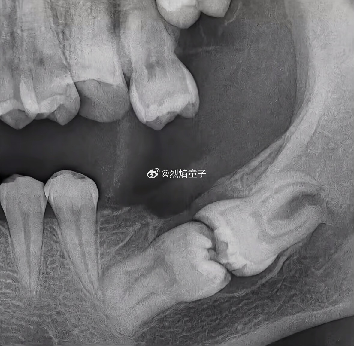 下面这两个算得上是祖传榫卯结构了上面那颗牙好八卦呀，伸长了脖子下来看