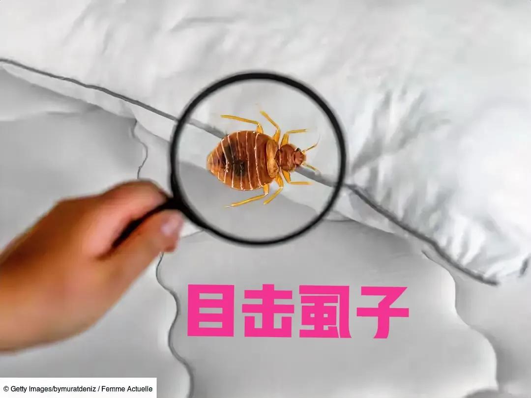 虱子！[无奈吐舌]注意，它有时候是“侦探”！小时候，家里又穷又破，个人卫生条件