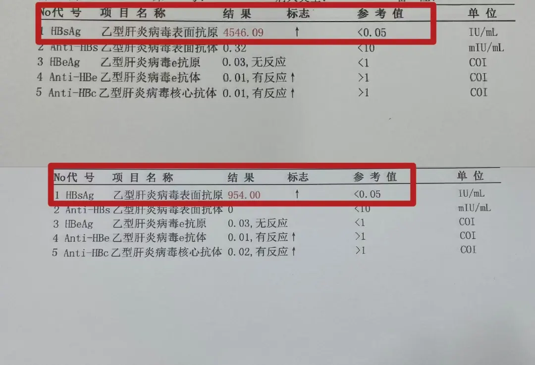 乙肝患者成功步入优势人群行列！20多岁小伙，表面抗原从4000+到小于...