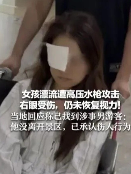 女子遭水枪攻击失明后续来了肇事男子已找到。但是，还没有找到赔偿的办法？