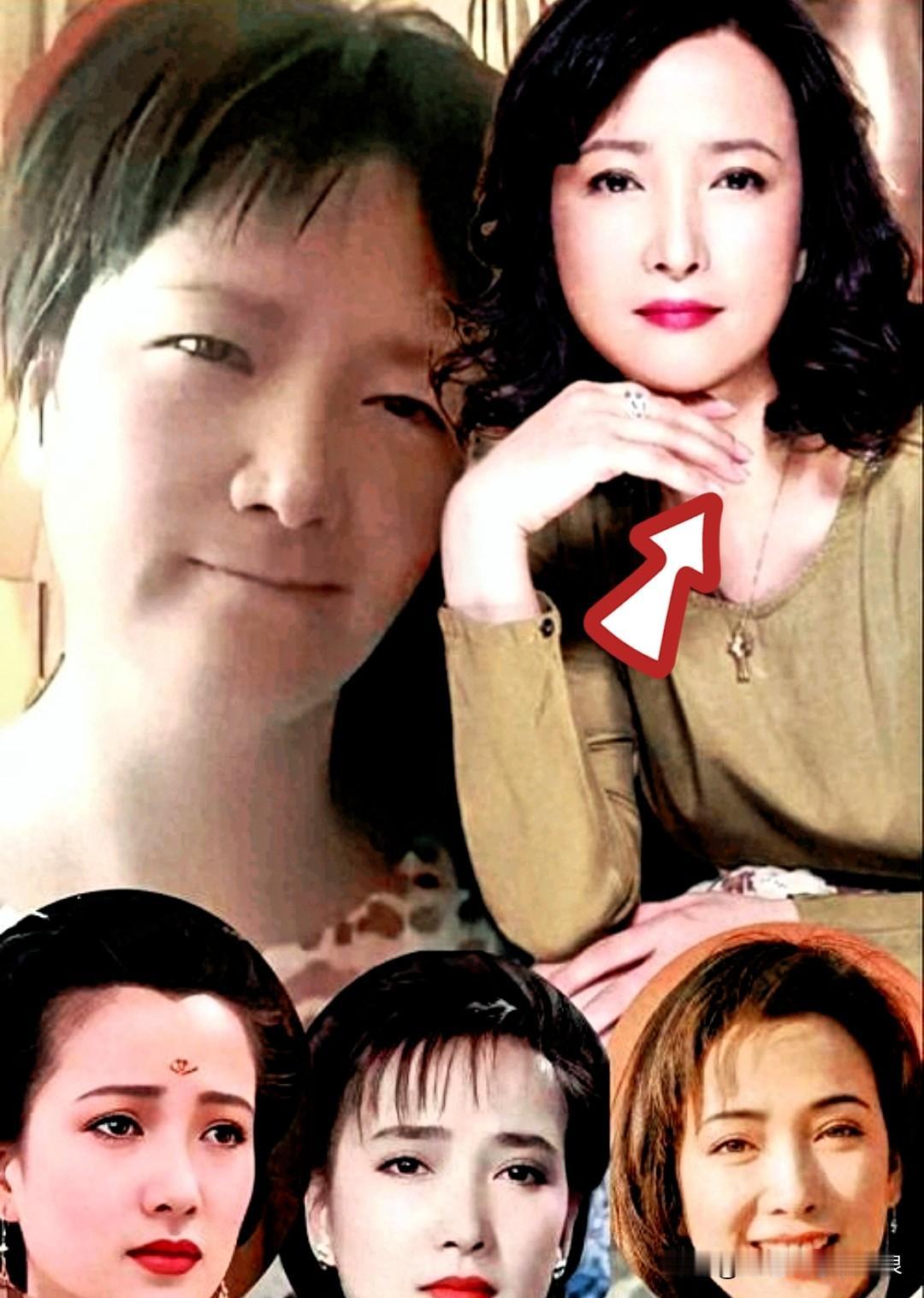 何晴这一病，算是把娱乐圈那层遮羞布给扯下来了。当年她突然中风，半个身子动不了