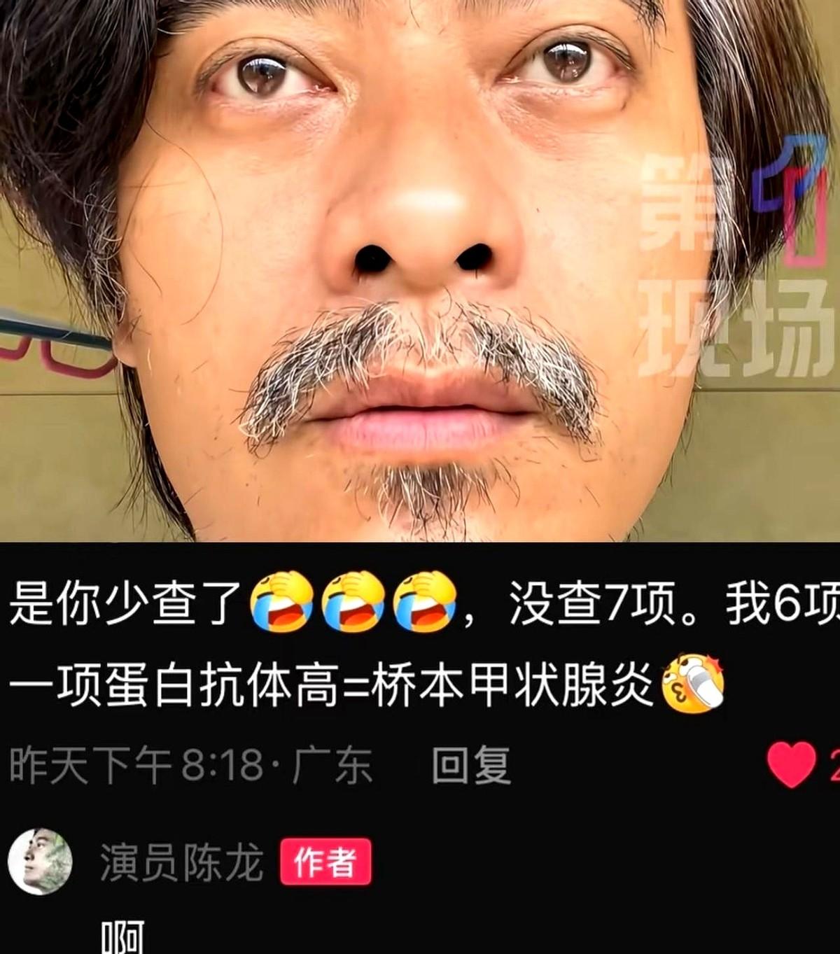 中年人交友的最高礼仪是什么？不是请你喝顿大酒。而是盯着你的脸，冷不丁来一句：