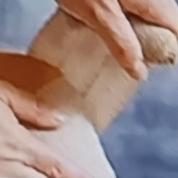 滑膜炎真是不少人的困扰，可别以为它只是中老年人的专利。数据显示，25-45岁