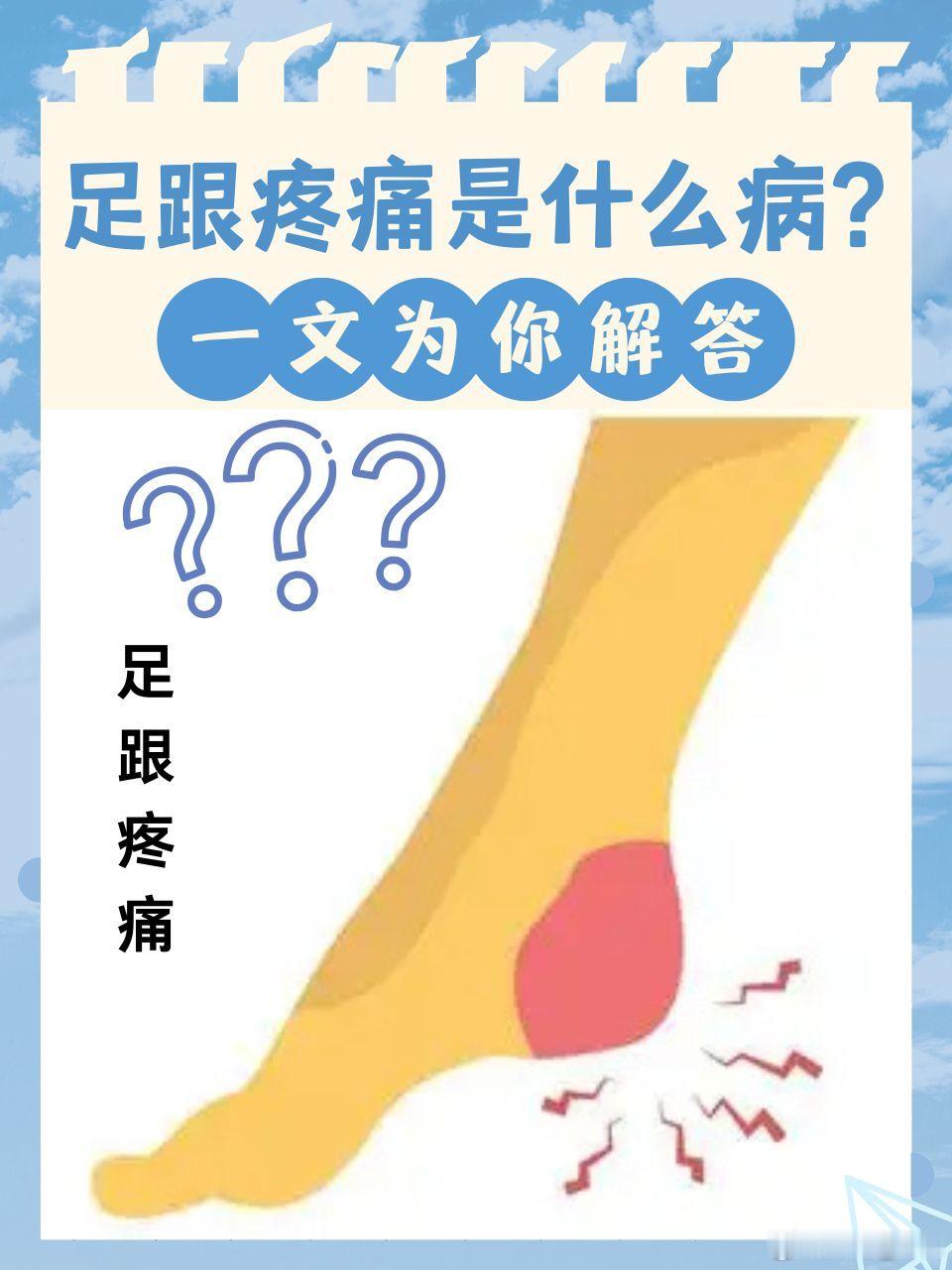 一首治疗“骨刺型”跟骨疼痛的秘方足跟痛，医学上常称为“跟骨骨刺”或“足跟骨质增