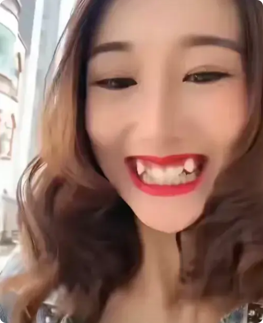 湖南，有一名女子在网上哭诉，她今年23岁，身高1米70，因为嘴里长着一对大虎牙，