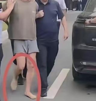 大家看看这双脚走烂了，这得遭啥罪啊。跑出十多公里，在玉米地里被一个农民老头发现。