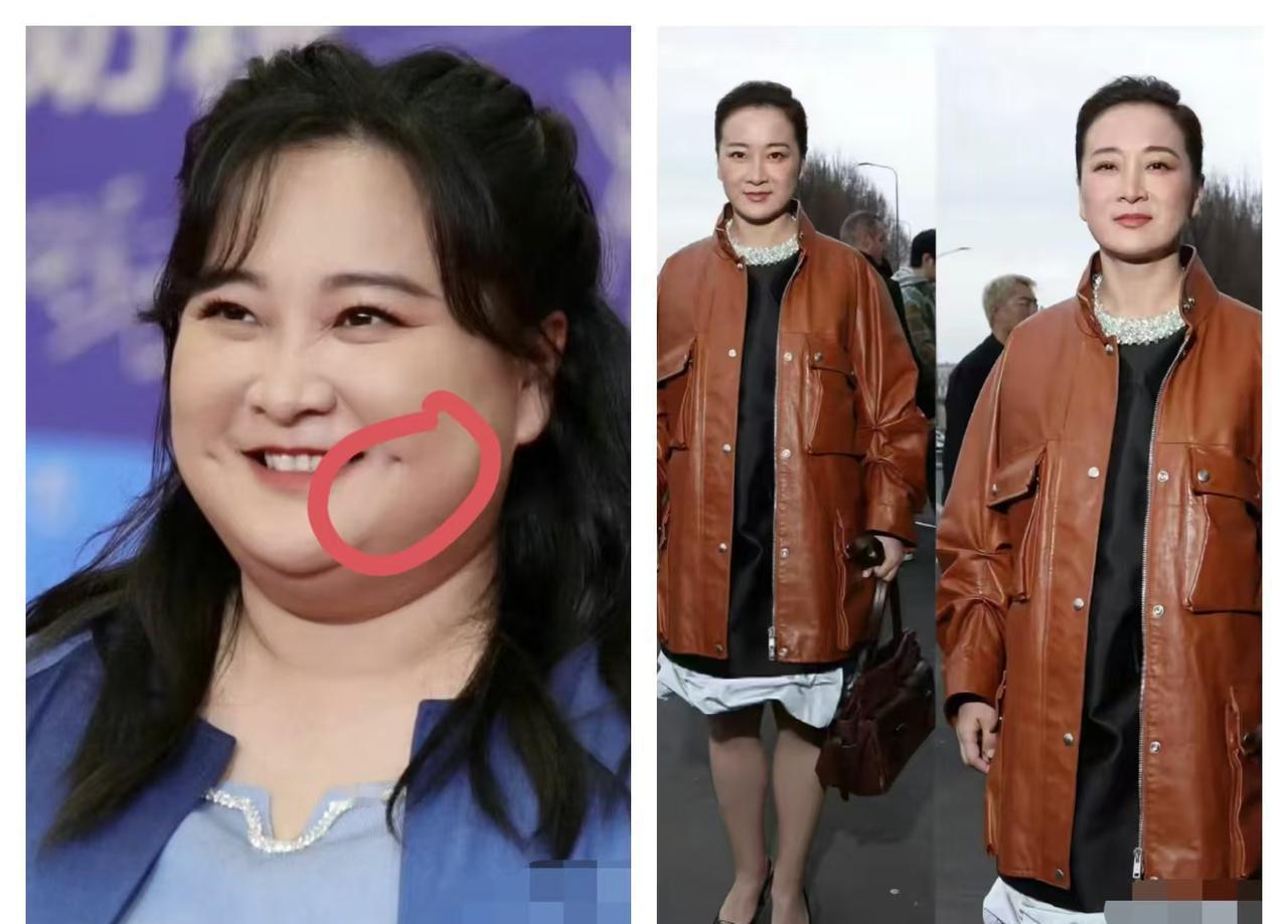 贾玲最大的损失不是100斤，是脸上那两个坑。懂点面相的心里都咯噔一下。那对酒