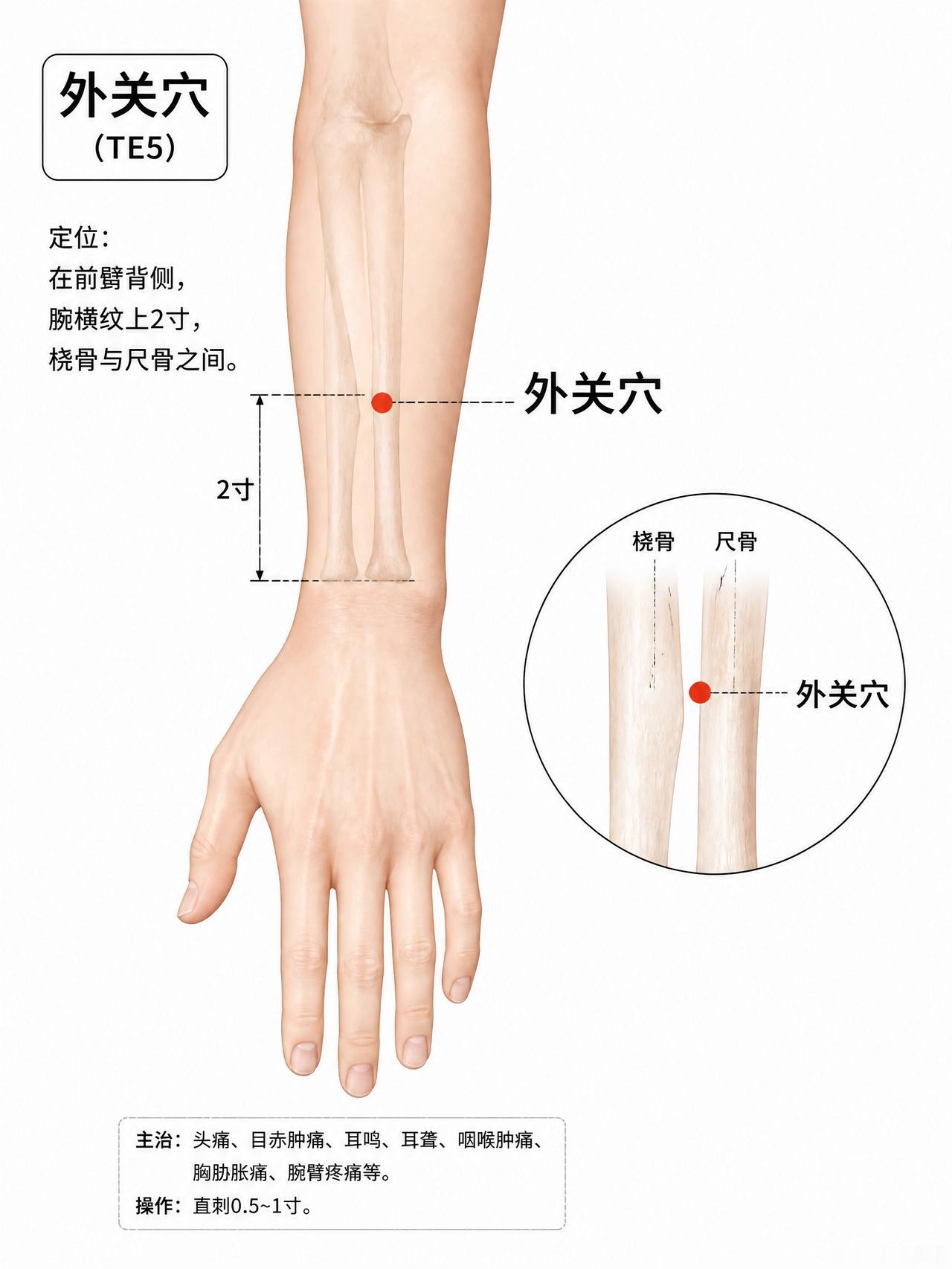 外关穴：手腕背面的“外邪关卡”，和内关正对门大多数人知道内关穴——手腕掌侧，