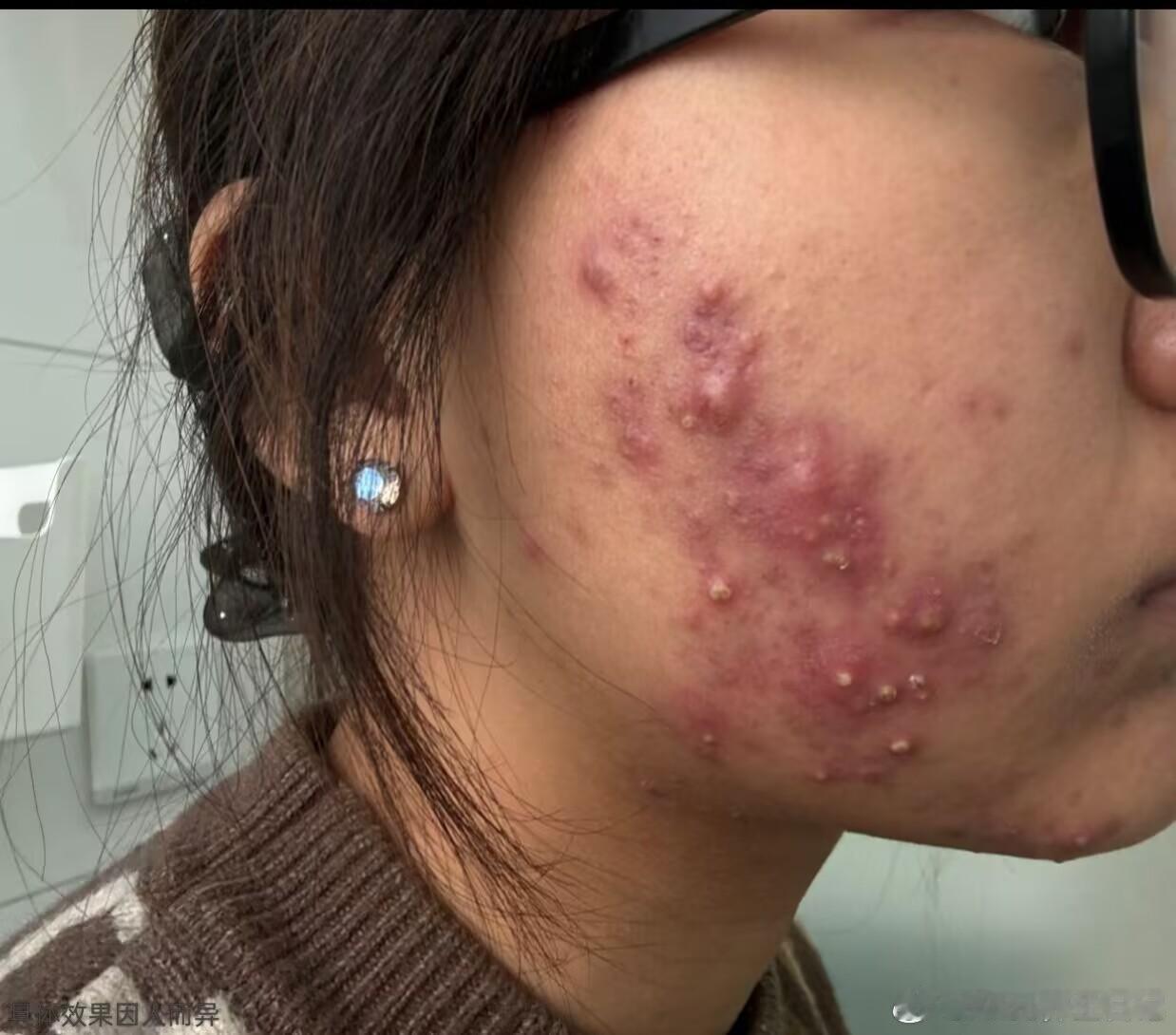 怎么样治疗方案😯😯😯