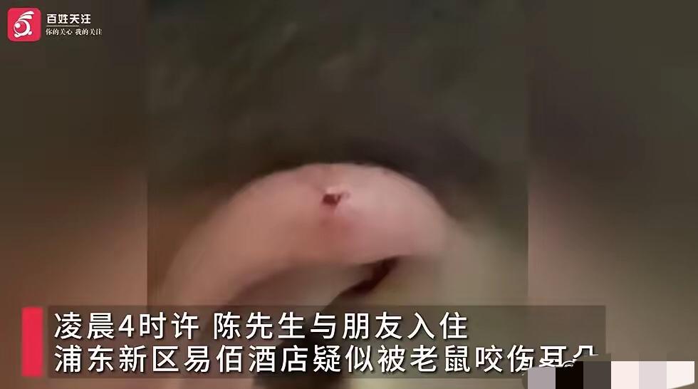 上海小伙酒店睡梦中疑被老鼠咬耳朵！酒店先赔后赖太离谱！3月12日晚，上海小伙小赵