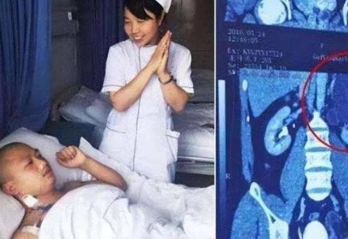 “我的丈夫有4个肾，他力气特别大！”2016年，贵州一男子精力旺盛、天生神力，白