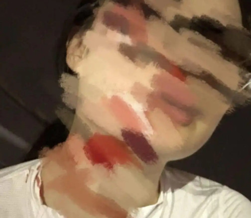 成都一女子夜骑时，突然人车腾空，面部、腿部瞬间鲜血淋漓。当女子缓过神看到罪魁祸首