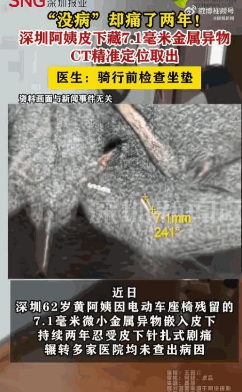 悲剧还是发生了！广东深圳，一62岁阿姨被外阴针扎般的剧痛折磨了整整两年，每走一步