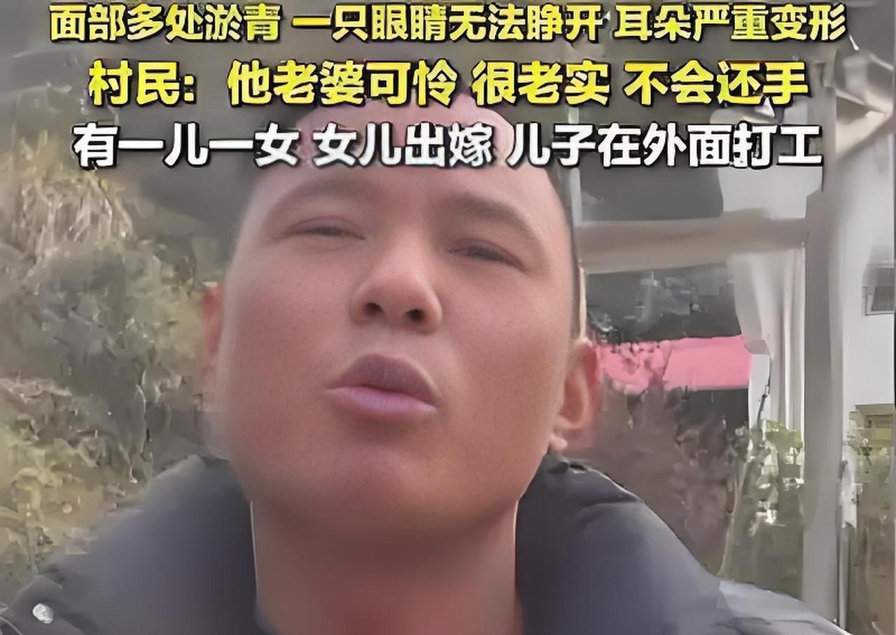 愤怒！湖南女子遭75岁丈夫酒后家暴，村民曝内情：以前正常现在呆呆的，常被打不还手