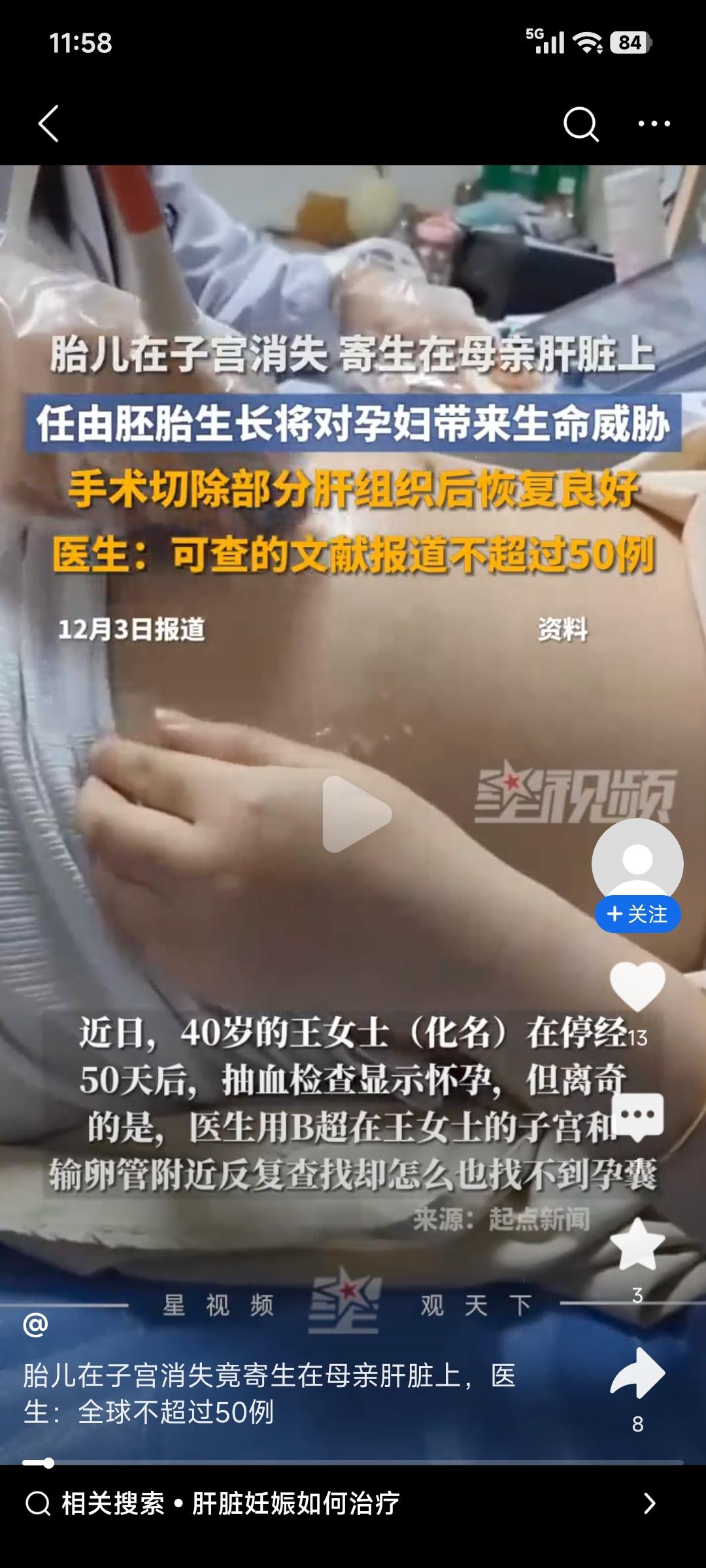 罕见的事儿真是年年有，今年特别多，胎儿居然在妈妈肝脏上“安家”了！西安一40岁的