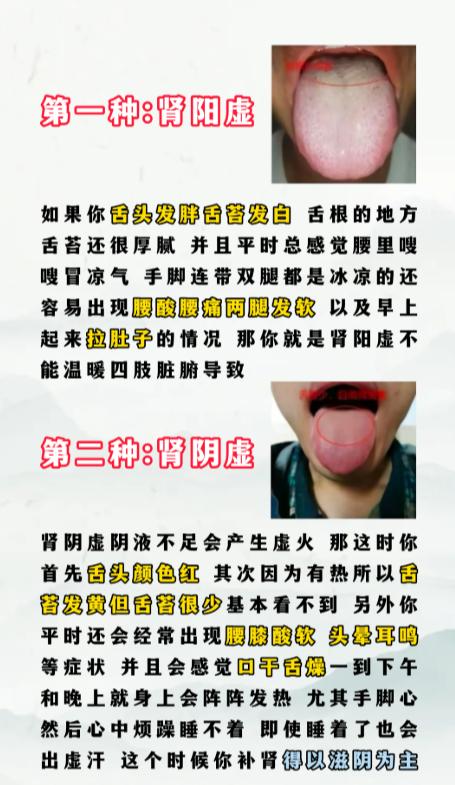 肾气亏虚有哪些证型？具体对应哪些症状？