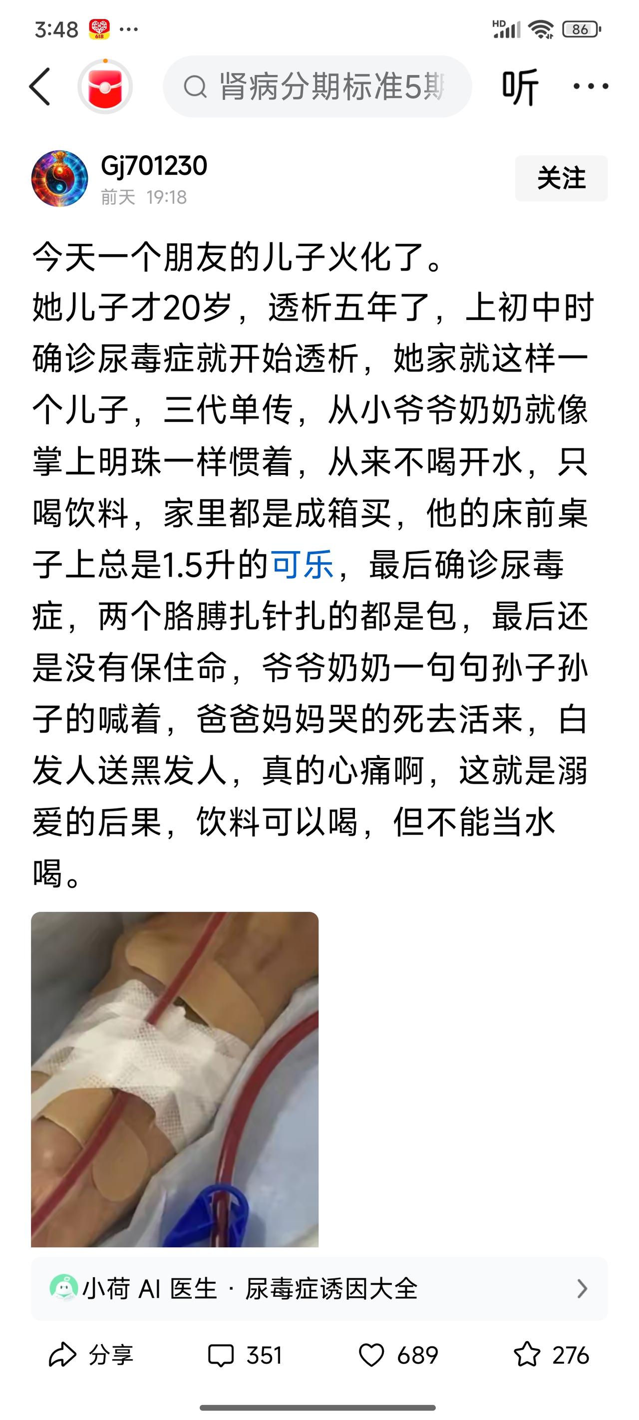 长期饮料代水对肾脏的致命伤害——一、原文核心信息梳理这是一条网络科普帖，