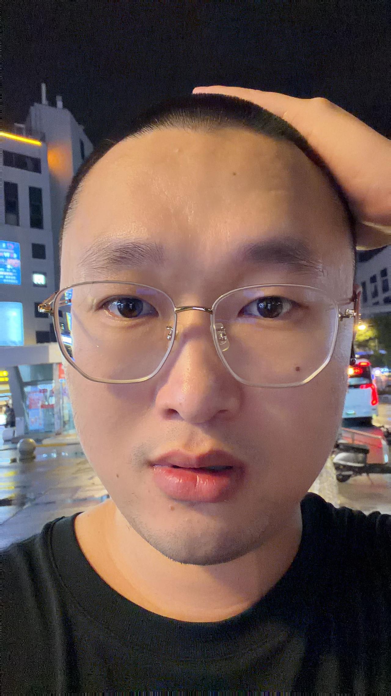 就挺秃然，看看涨回来和长回来，哪个快。