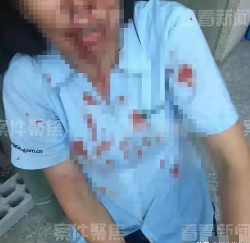 上海，一外甥带5人上门，对舅舅进行围殴，舅妈激愤之下，拿起一瓶强腐蚀性液体，直接