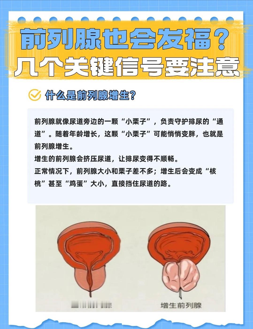 前列腺也会“发福”，聊聊中老年高发的前列腺增生