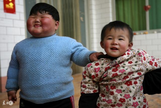 爸妈一定会遗传给孩子的8个外貌特征, 准到没话说