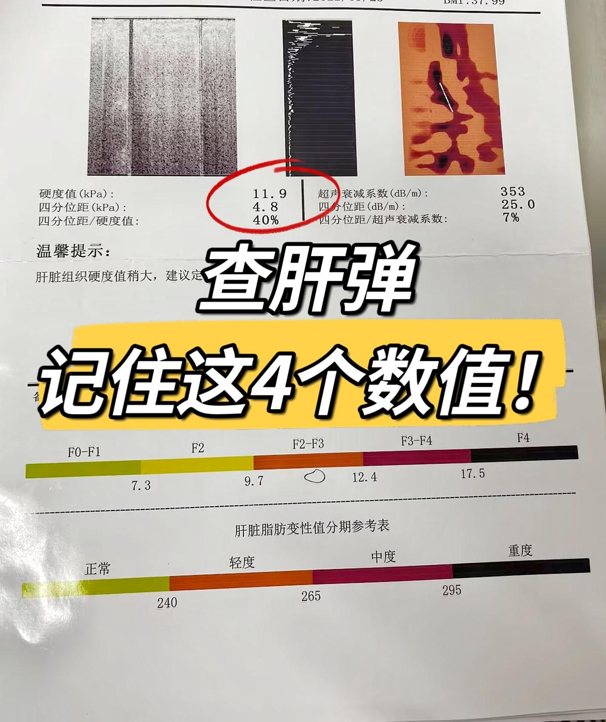 查肝弹，记住这4个数值！数值在7.3kPa以下，这个阶段属于正常范围。...