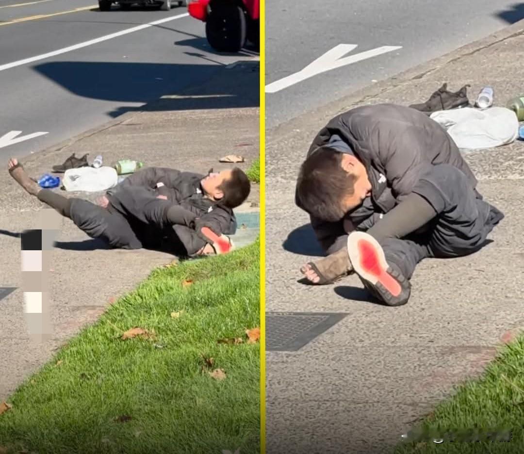 这是一名居无定所的女性，她正饱受因化学物质诱发的精神病折磨，这也是当下在美国，物