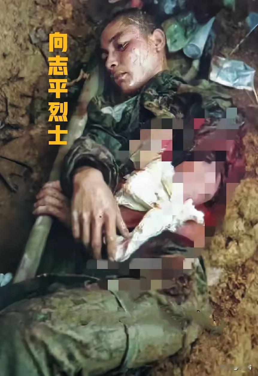 这是一张令国人无比心痛的战地照片，镜头中这名身受重伤，处在弥留之际的我军战士，就