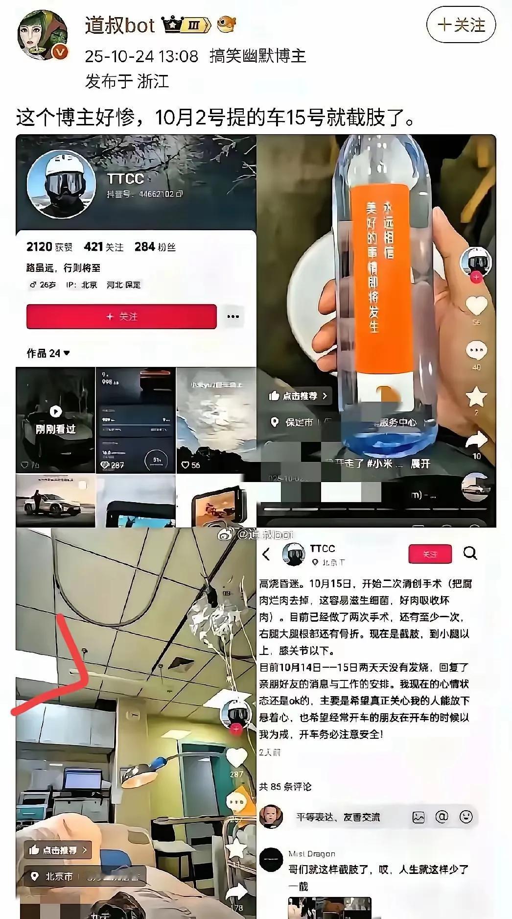 10月2号刚兴奋提车,9号就撞车卡在驾驶室,15号右腿没能保住,从狂喜到绝望不过