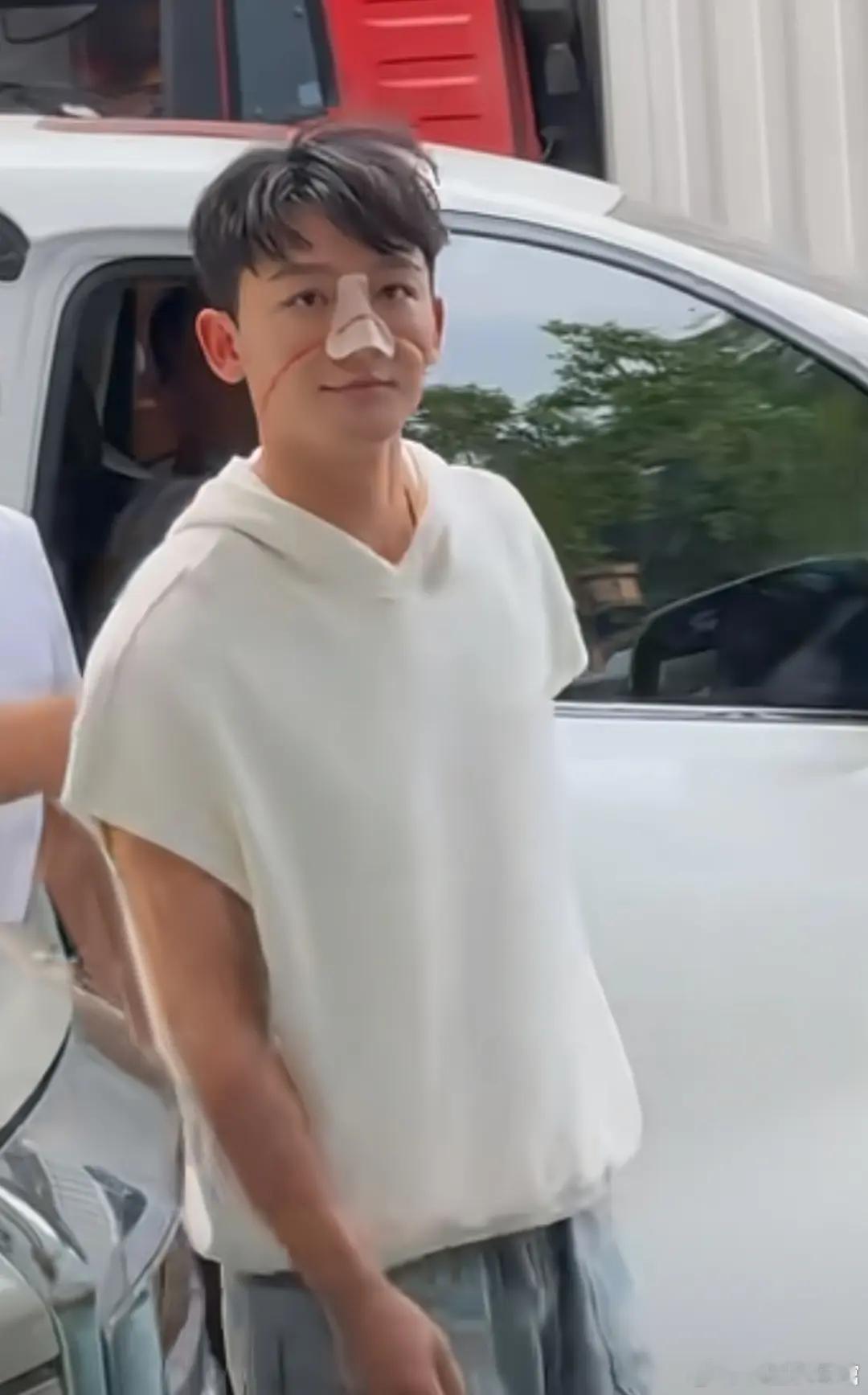 张晚意这鼻子看着很严重啊希望早点儿好起来吧