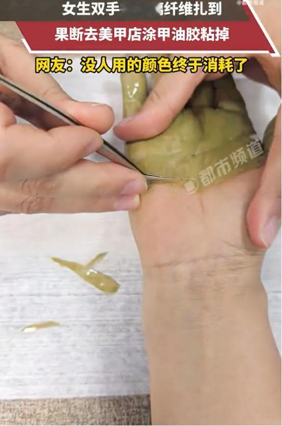 这是真聪明！浙江，一女生双手被玻璃纤维扎到，可她既没有自己拔，没有去医院，而是走