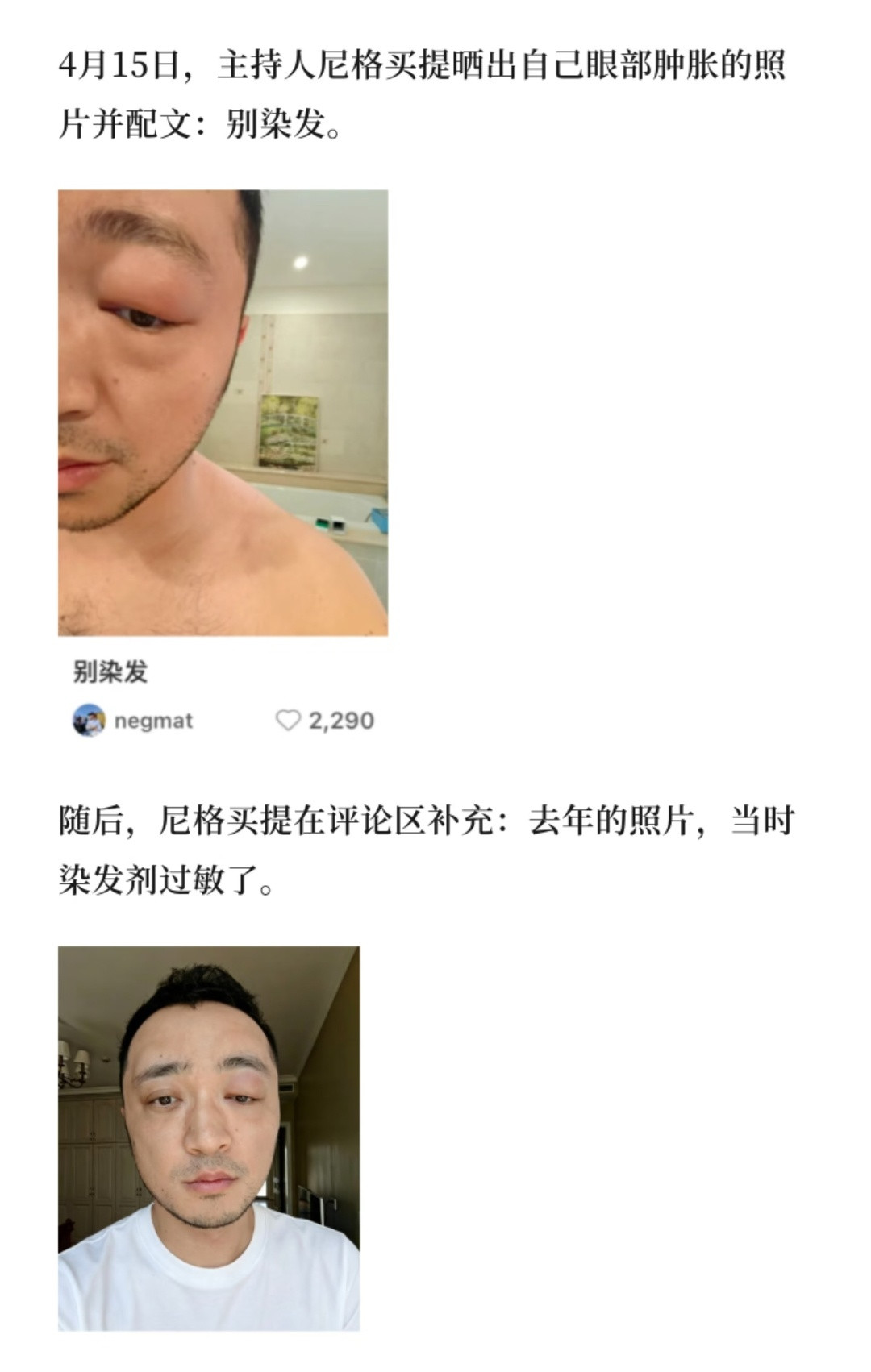 哈哈哈肿的跟换了一个人一样