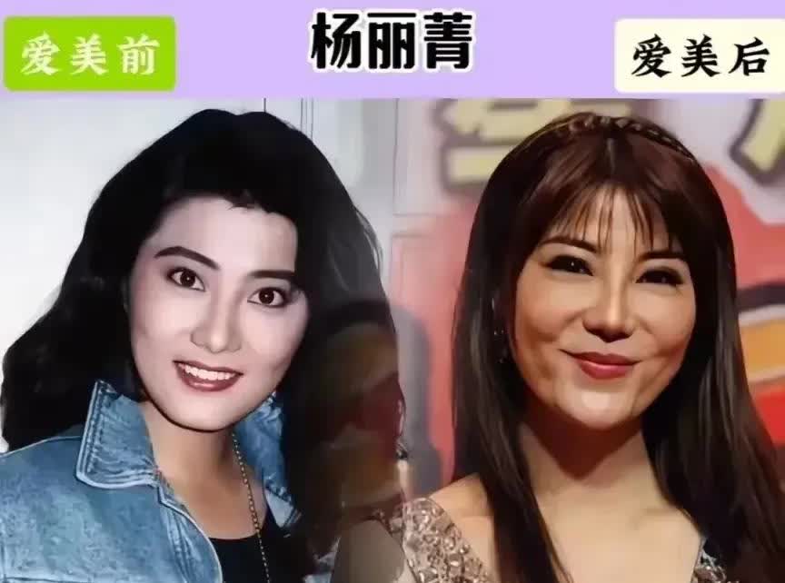 整残了的十位女明星哪一位只可惜