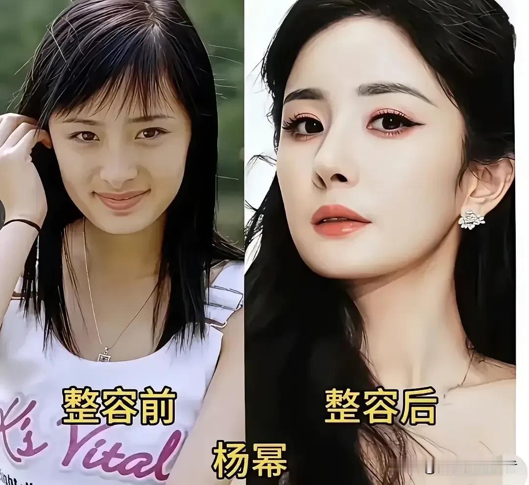 5位整容女明星，你觉得谁的变化最大呢？