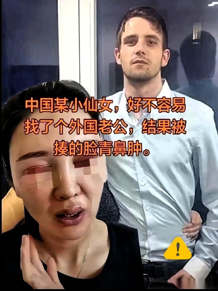 洋女婿的巴掌，扇醒了谁？被打了。就是那个前阵子在朋友圈疯狂刷屏，逢人便炫