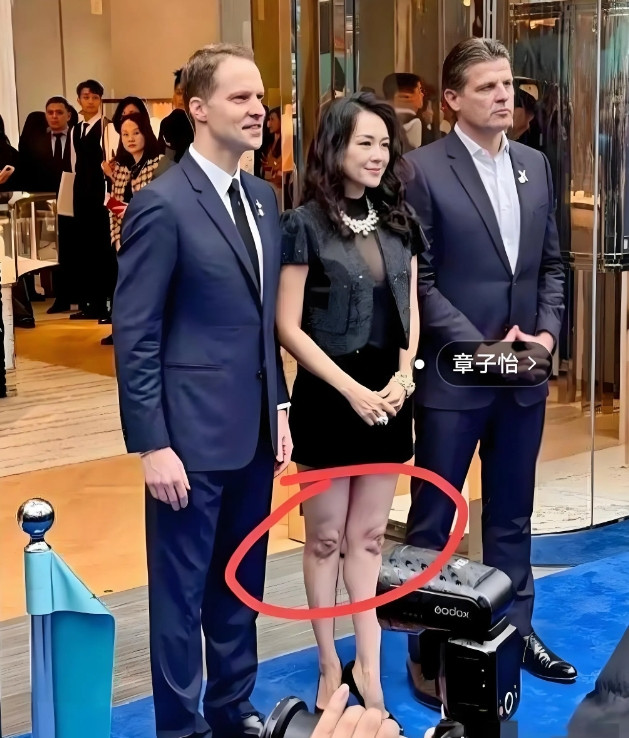 这膝盖怎么是这样的？
