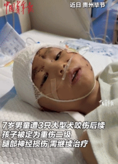 中国青年报发声了！7岁男孩被3只恶犬咬致重伤二级，治疗花20多万，狗主却只赔5万