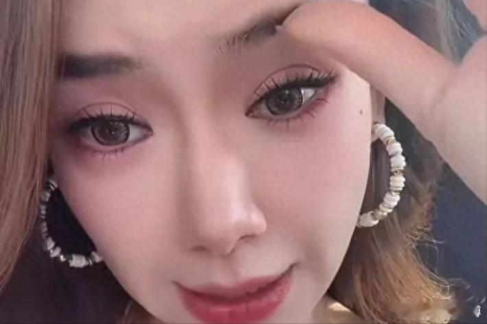 【戚薇大方承认医美过度，这些明星却靠微调美出圈】1、戚薇肉毒死打太多，适得其反