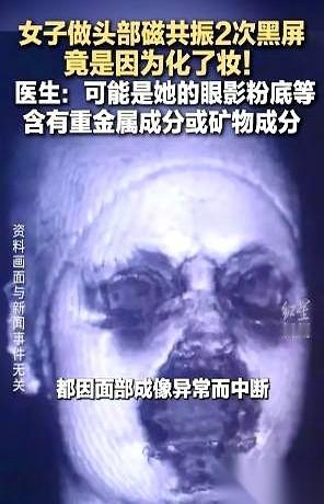 差点就成了一桩悬案。一个姑娘，头晕得站不稳，躺进那个嗡嗡响的核磁共振大圈圈里，