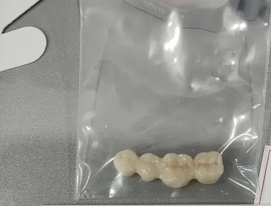 疼疼疼，那种钻心剜骨的痛，女子47岁因为小时候特别爱吃糖，导致年纪轻轻就更换了四