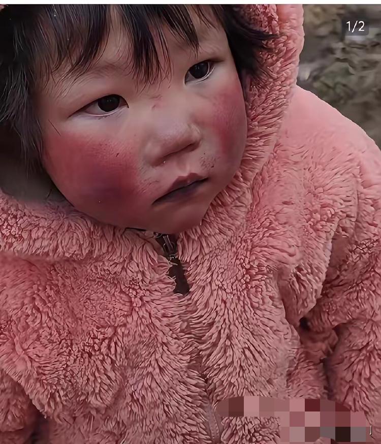 谁能想象，一个4岁孩子的童年，是在缺氧中熬过来的？河南小女孩佳佳，一出生就带