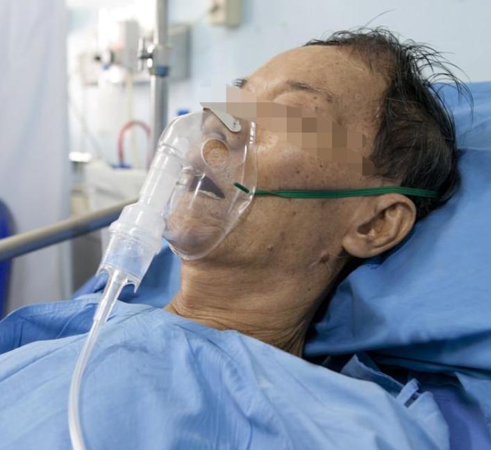 “痛心！”河北邯郸，一88岁老人肺炎入院治疗。 老人能自主呼吸，医生却给他上