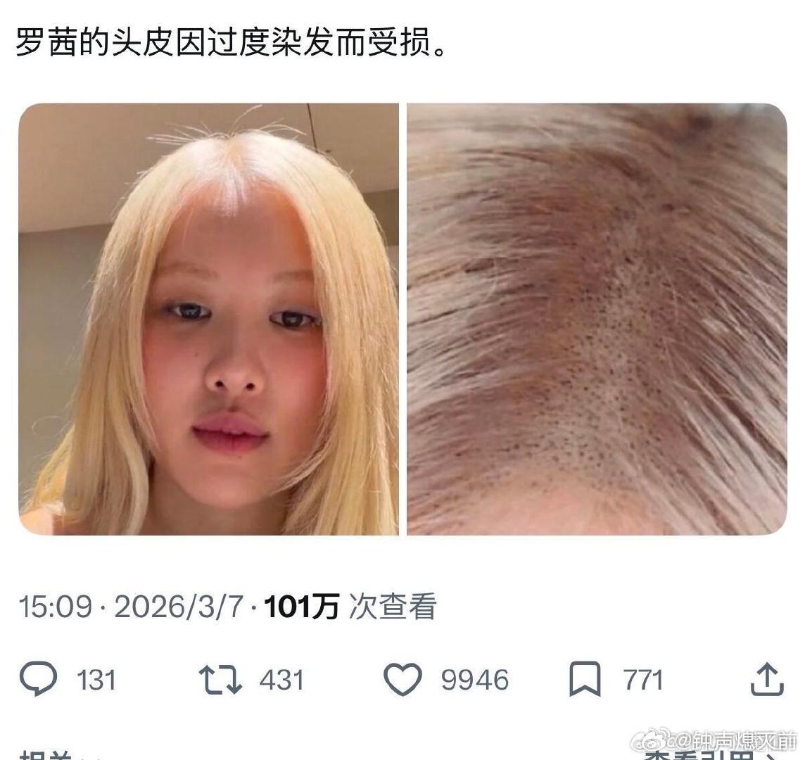 我丢频繁染发很伤身体吧，为啥不戴假发捏