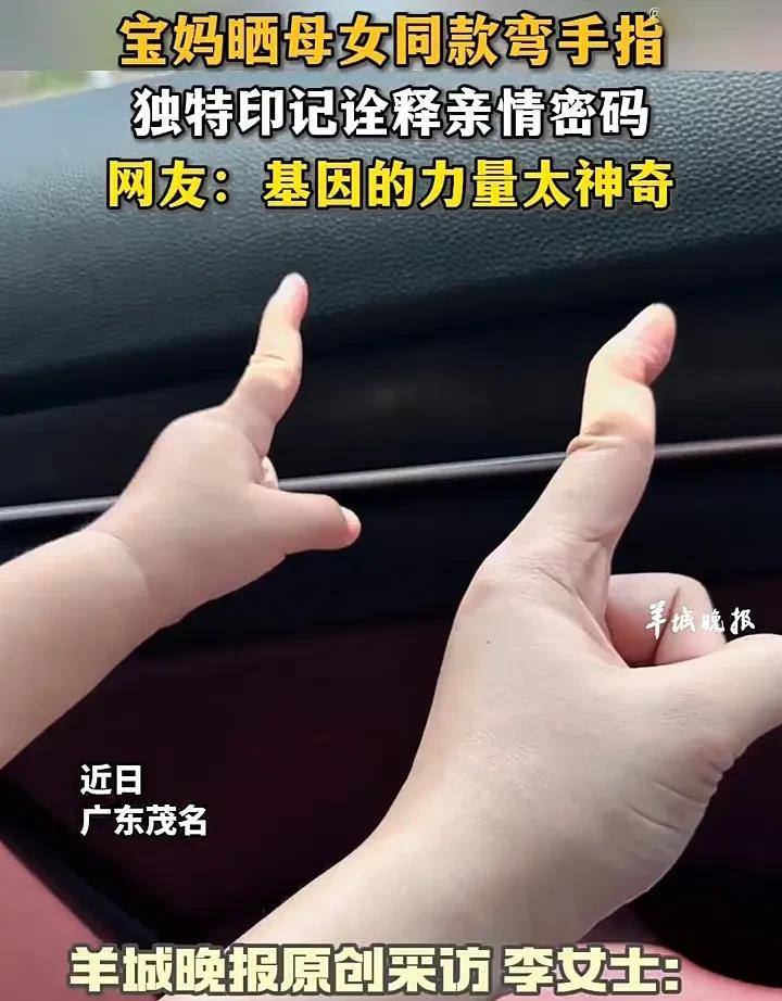神奇的遗传基因！近日，广东茂名一名女子发视频称，女儿有着跟自己一样伸不直的手指，